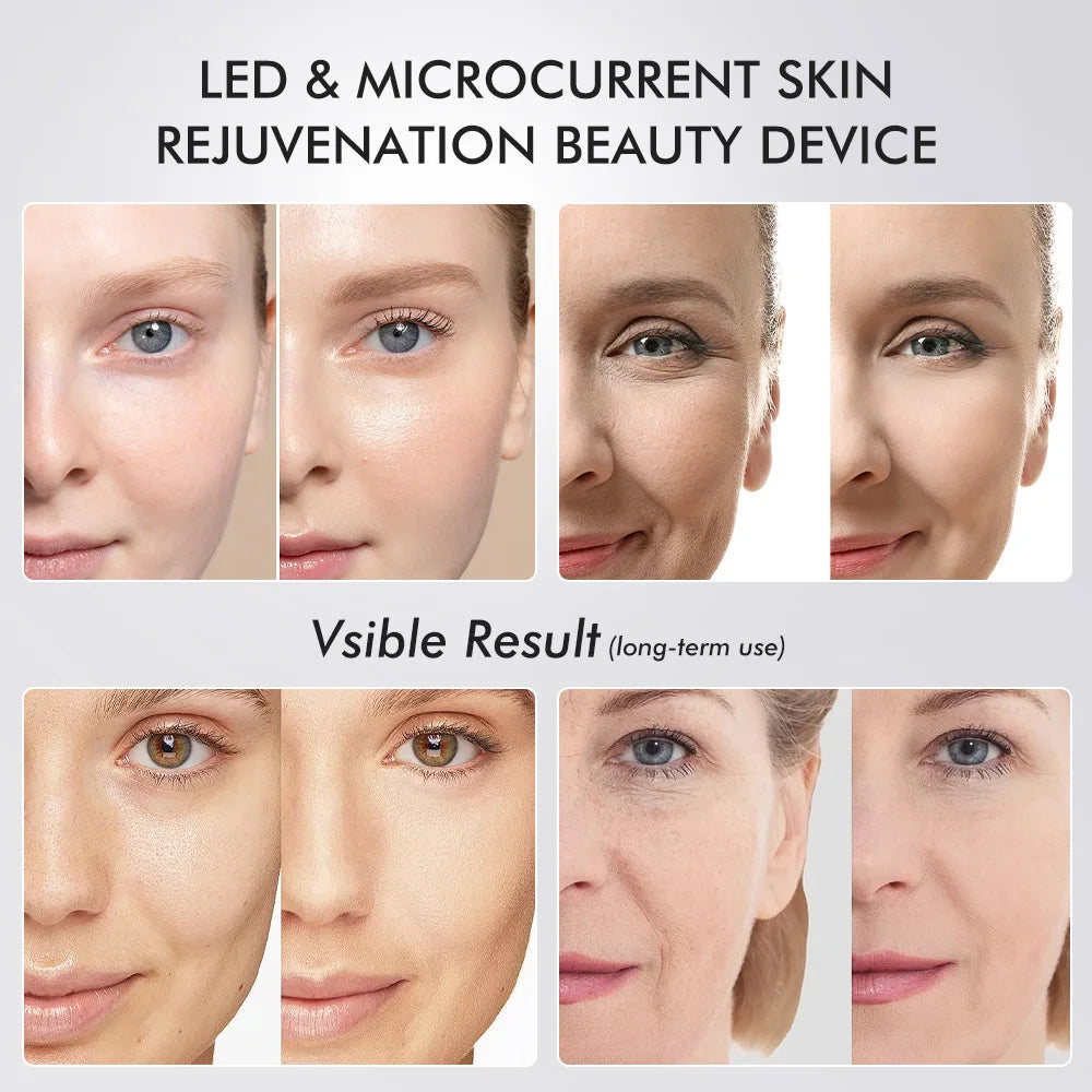 UBilli 6-in-1 GlowBoost Facial Device – Lift, Tighten, Brighten & Clear